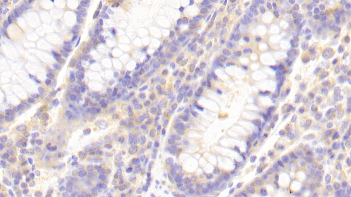 DAB staining on fromalin fixed paraffin-embedded Liver tissue)