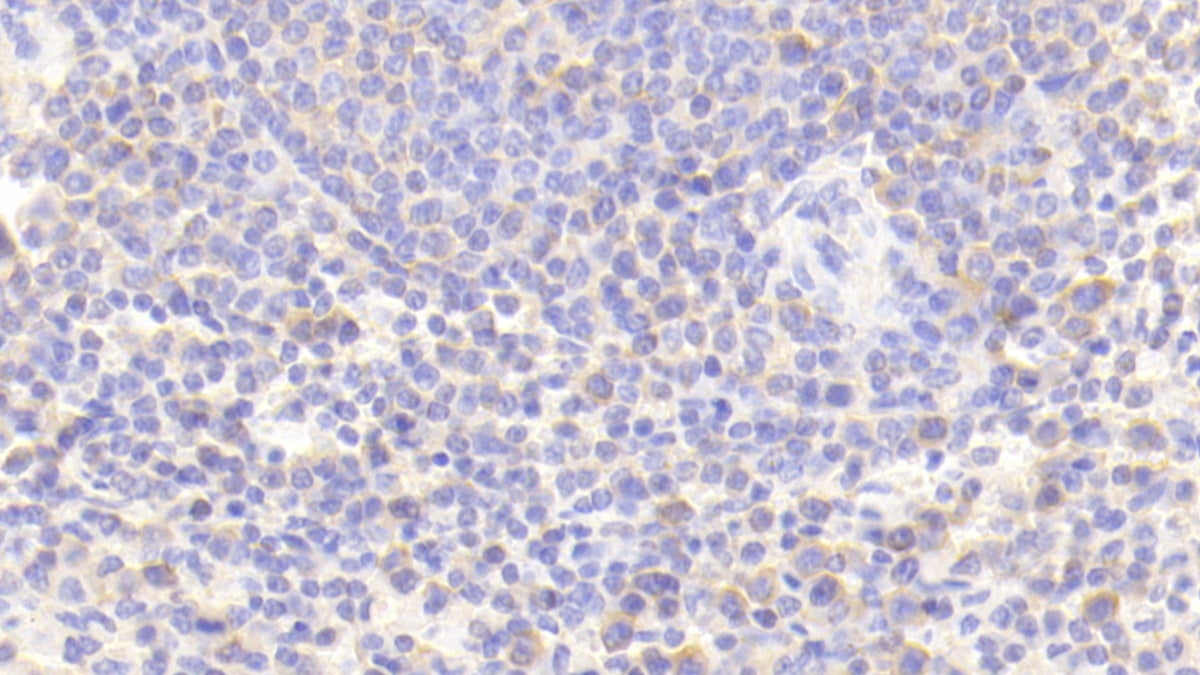 Toll Like Receptor 8 (TLR8) Polyclonal Antibody - image 5