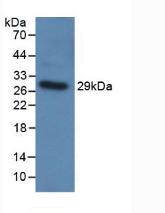 Western Blot; Sample: Hela cell lysate; Primary Ab: 2μg/ml Rabbit Anti-Human TLR5 Antibody; Second Ab: 0.2µg/mL HRP-Linked Caprine Anti-Rabbit IgG Polyclonal Antibody;