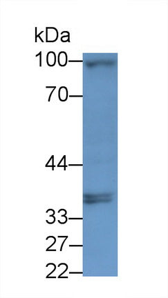 DAB staining on IHC-P; Samples: Human Stomach Tissue; Primary Ab: 20μg/ml Rabbit Anti-Human TLR5 Antibody Second Ab: 2µg/mL HRP-Linked Caprine Anti-Rabbit IgG Polyclonal Antibody