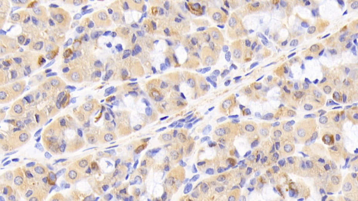 DABstainingonIHC-P.Samples:HumanTissue)