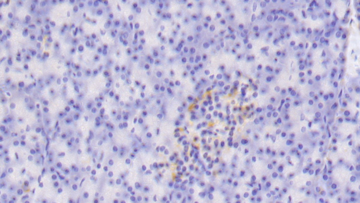 Toll Like Receptor 5 (TLR5) Polyclonal Antibody - image 5