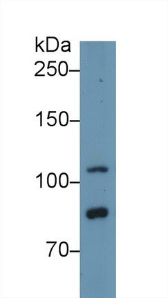 Western Blot; Sample: Recombinant protein.
