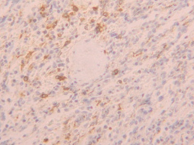 Toll Like Receptor 5 (TLR5) Polyclonal Antibody - image 5