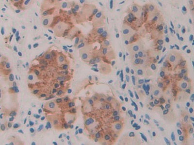Toll Like Receptor 3 (TLR3) Polyclonal Antibody - image 4