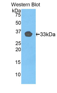 Toll Like Receptor 1 (TLR1) Polyclonal Antibody - image 2