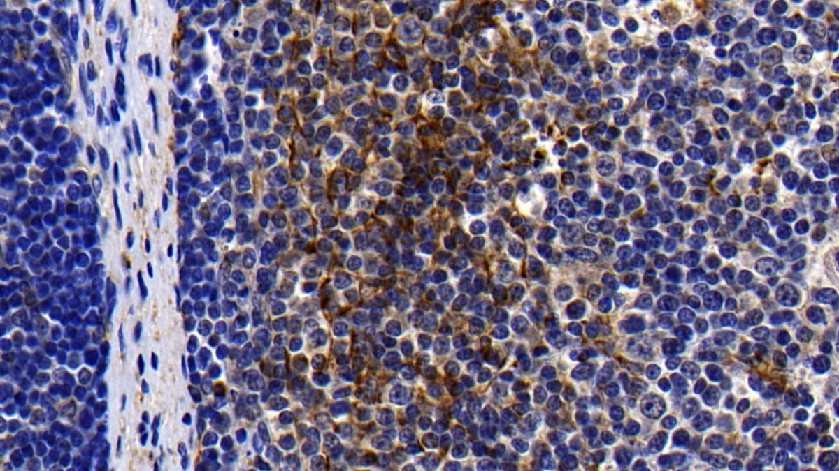 Toll Like Receptor 1 (TLR1) Polyclonal Antibody - image 3