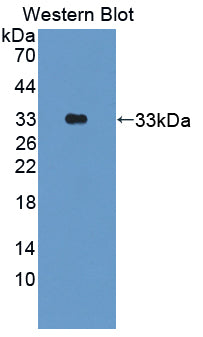 Protein Kinase N2 (PKN2) Polyclonal Antibody - image 3
