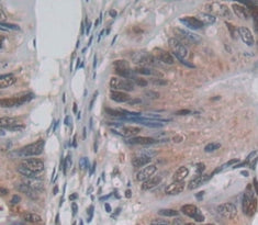Protein Kinase N2 (PKN2) Polyclonal Antibody - image 4