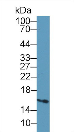 Western Blot; Sample: Recombinant protein.