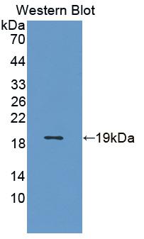 Fatty Acid Binding Protein 5 (FABP5) Polyclonal Antibody - image 3