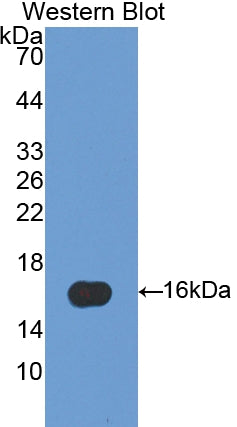 Fatty Acid Binding Protein 5 (FABP5) Polyclonal Antibody - image 2