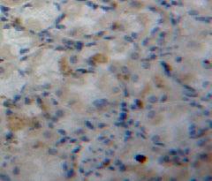Fatty Acid Binding Protein 5 (FABP5) Polyclonal Antibody - image 3
