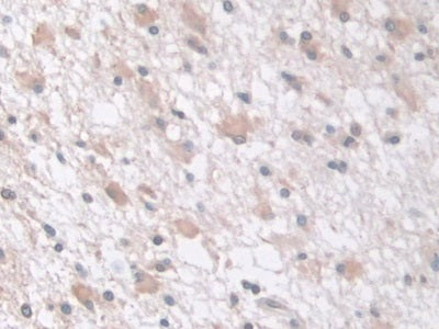 DAB staining on IHC-P; Samples: Human Cerebrum Tissue;  Primary Ab: 10µg/ml Rabbit Anti-Human tPK1 A