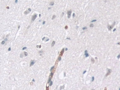 Tau-Protein Kinase 1 (tPK1) Polyclonal Antibody - image 4