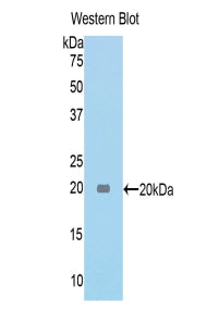 DAB staining on IHC-P; Samples: Rat Kidney Tissue; Primary Ab: 20μg/ml Rabbit Anti-Rat TNC Antibody Second Ab: 2µg/mL HRP-Linked Caprine Anti-Rabbit IgG Polyclonal Antibody