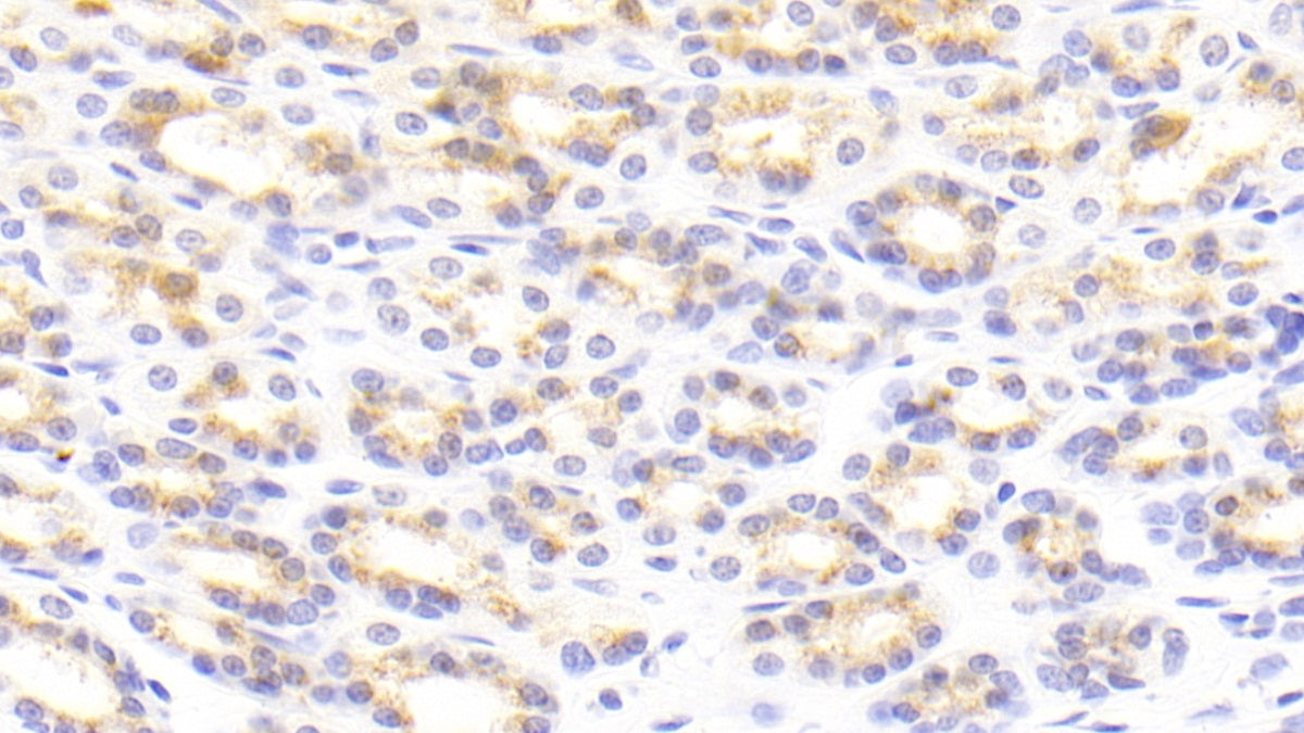 Tenascin C (TNC) Polyclonal Antibody - image 5
