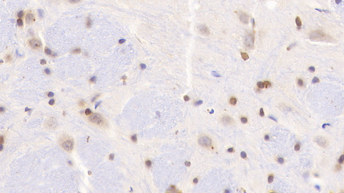 A Disintegrin And Metalloproteinase With Thrombospondin 7 (ADAMTS7) Polyclonal Antibody - image 3