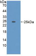 A Disintegrin And Metalloproteinase With Thrombospondin 7 (ADAMTS7) Polyclonal Antibody - image 2