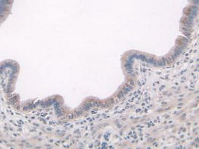DAB staining on IHC-P; Samples: Mouse Stomach Tissue.