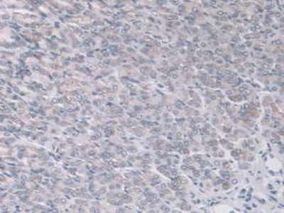 A Disintegrin And Metalloproteinase With Thrombospondin 7 (ADAMTS7) Polyclonal Antibody - image 4