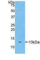 A Disintegrin And Metalloproteinase With Thrombospondin 7 (ADAMTS7) Polyclonal Antibody - image 2