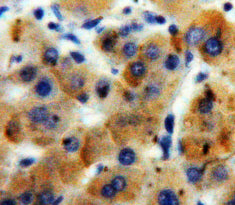 A Disintegrin And Metalloproteinase With Thrombospondin 7 (ADAMTS7) Polyclonal Antibody - image 3