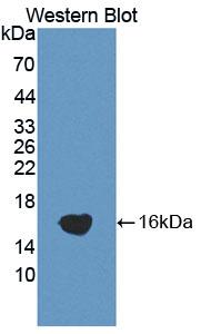 A Disintegrin And Metalloproteinase With Thrombospondin 1 (ADAMTS1) Polyclonal Antibody - image 2