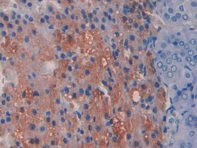 DAB staining on fromalin fixed paraffin- embedded adrenal gland tissue)