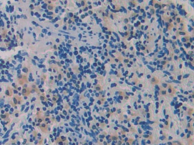 A Disintegrin And Metalloproteinase With Thrombospondin 1 (ADAMTS1) Polyclonal Antibody - image 4