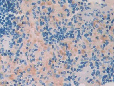 A Disintegrin And Metalloproteinase With Thrombospondin 1 (ADAMTS1) Polyclonal Antibody - image 3