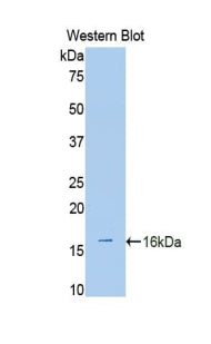 A Disintegrin And Metalloproteinase With Thrombospondin 1 (ADAMTS1) Polyclonal Antibody - image 2