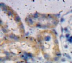 A Disintegrin And Metalloproteinase With Thrombospondin 1 (ADAMTS1) Polyclonal Antibody - image 3