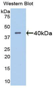 A Disintegrin And Metalloproteinase With Thrombospondin 1 (ADAMTS1) Polyclonal Antibody - image 2