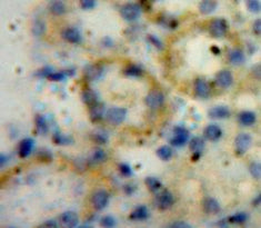 A Disintegrin And Metalloproteinase With Thrombospondin 1 (ADAMTS1) Polyclonal Antibody - image 3