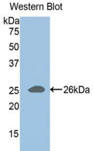 A Disintegrin And Metalloproteinase With Thrombospondin 1 (ADAMTS1) Polyclonal Antibody - image 2