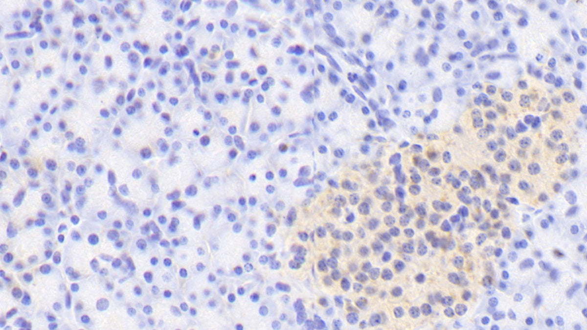 A Disintegrin And Metalloproteinase With Thrombospondin 1 (ADAMTS1) Polyclonal Antibody - image 3