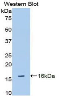 A Disintegrin And Metalloproteinase With Thrombospondin 1 (ADAMTS1) Polyclonal Antibody - image 2