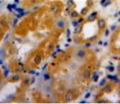 A Disintegrin And Metalloproteinase With Thrombospondin 1 (ADAMTS1) Polyclonal Antibody - image 3