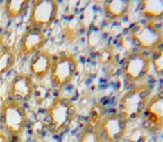 A Disintegrin And Metalloproteinase With Thrombospondin 1 (ADAMTS1) Polyclonal Antibody - image 3