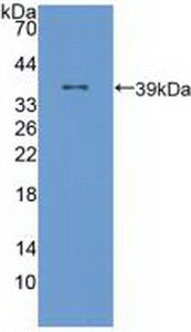 Arachidonate-12-Lipoxygenase (ALOX12) Polyclonal Antibody - image 2
