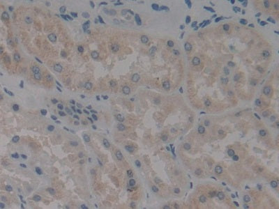 DAB staining on IHC-P; Samples: Human Liver Tissue