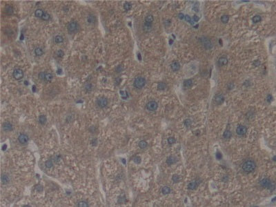 Arachidonate-12-Lipoxygenase (ALOX12) Polyclonal Antibody - image 4