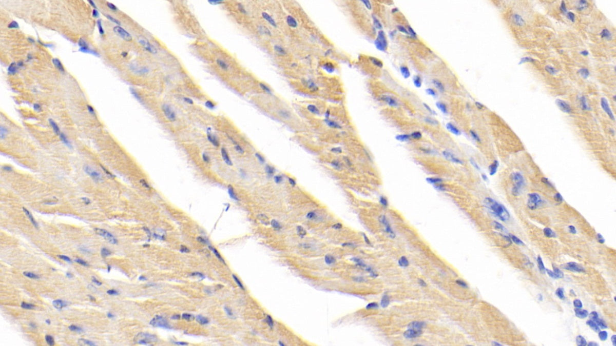 DAB staining on fromalin fixed paraffin-embedded kidney tissue)
