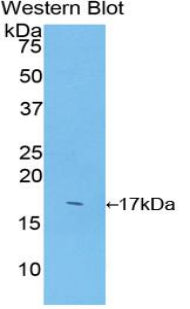 Superoxide Dismutase 1 (SOD1) Polyclonal Antibody - image 2