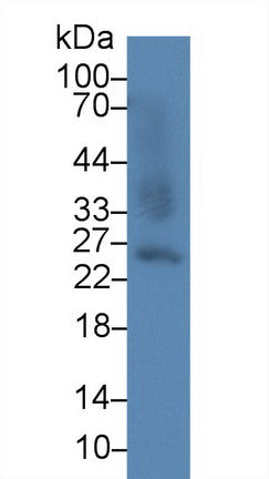 Western Blot; Sample: Recombinant protein.