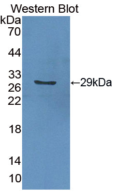 DAB staining on IHC-P; Samples: Mouse Kidney Tissue;  Primary Ab: 10µg/ml Rabbit Anti-Mouse GSTa2 An