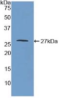 Monoamine Oxidase A (MAOA) Polyclonal Antibody - image 2