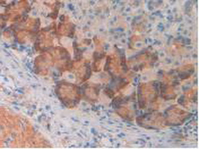 Monoamine Oxidase A (MAOA) Polyclonal Antibody - image 4