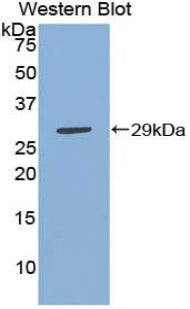 DAB staining on IHC-P; Samples: Mouse Testis Tissue;  Primary Ab: 10µg/ml Rabbit Anti-Mouse IKBIP An